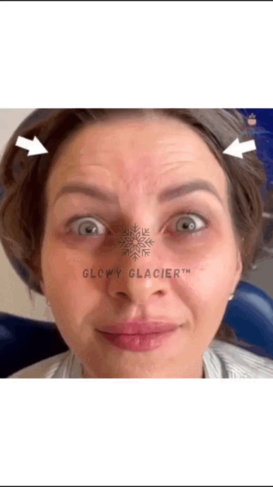 glacier skin massager